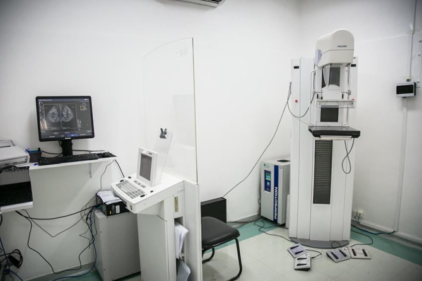 Mamografia digital reduz radiação e elimina espera de pacientes em S.Caetano