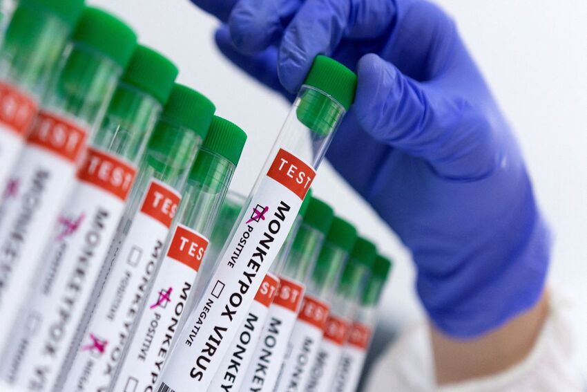 exame para detectar varíola do macaco
