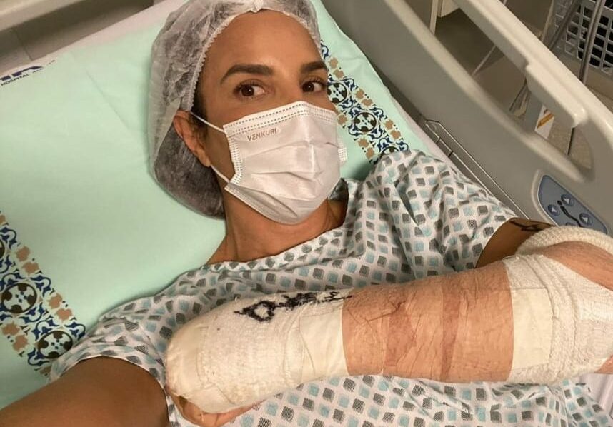 Ivete Sangalo sofre acidente ao esquiar: ‘Quebrei meu punho em dois lugares’