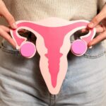 Endometriose