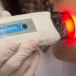 Tratamento inovador de câncer de pele