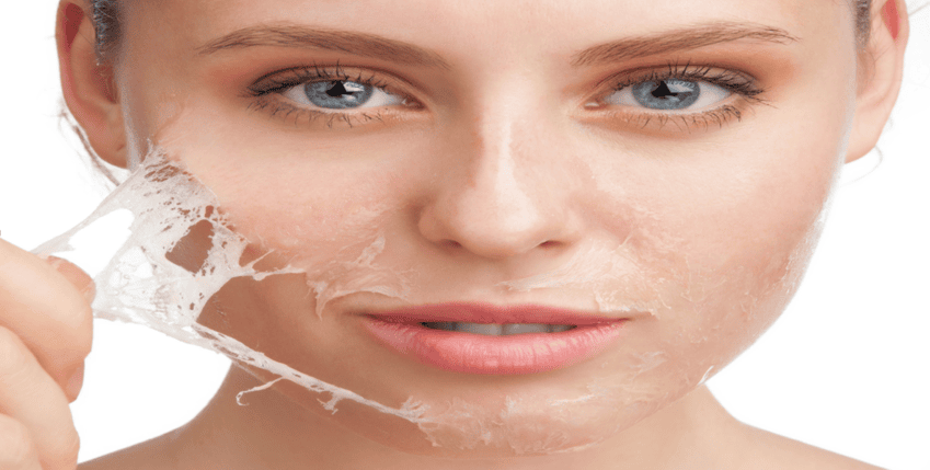 Peeling de fenol