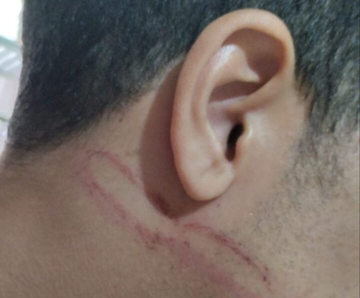 agressão de jovem