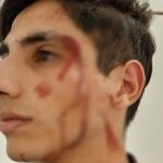jovem agredido