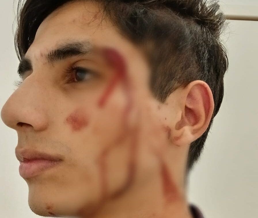 jovem agredido