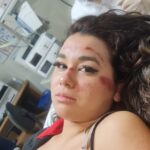 jovem atropelada