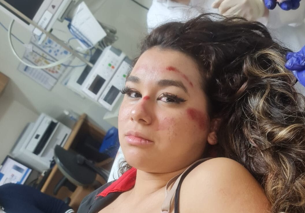 jovem atropelada