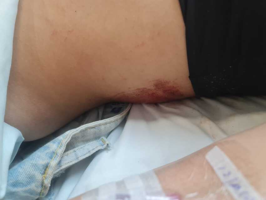 jovem atropelada