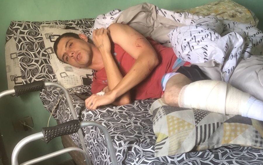 homem agredido por cães pitbulls