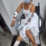 mulher ferida por cães