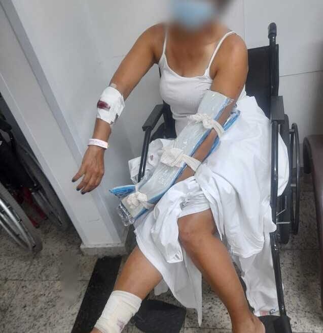 mulher ferida por cães