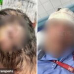 em Diadema, um motorista de trólebus foi agredido com uma pedrada na cabeça por jovens neste sábado