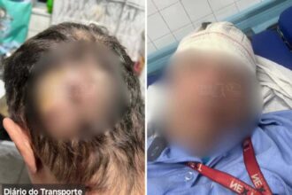 em Diadema, um motorista de trólebus foi agredido com uma pedrada na cabeça por jovens neste sábado