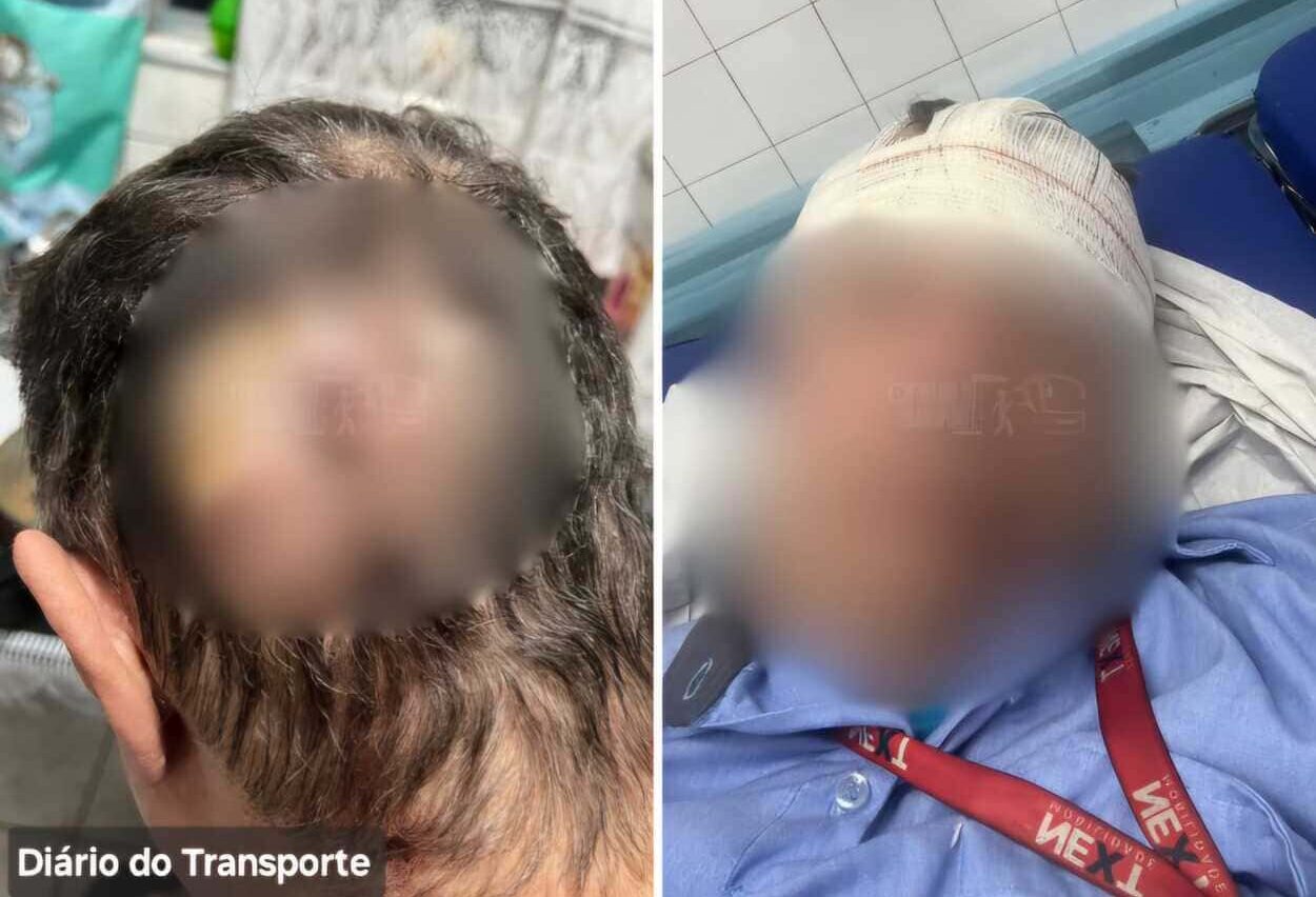 em Diadema, um motorista de trólebus foi agredido com uma pedrada na cabeça por jovens neste sábado