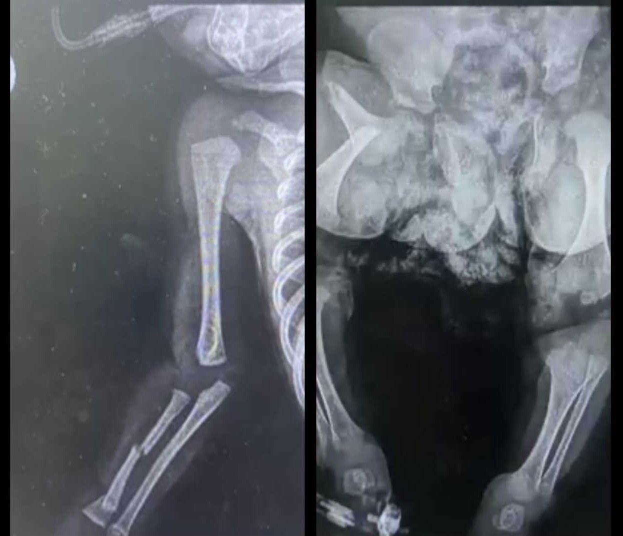 orreu no último sábado (25/10) após nove dias internado com graves lesões pelo corpo.