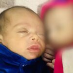 Bento, que deu entrada no hospital com queimaduras, múltiplas fraturas e traumatismo craniano; irmã gêmea também apresentava marcas de agressão