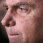 Com crise persistente de soluços, Bolsonaro faz nova cirurgia