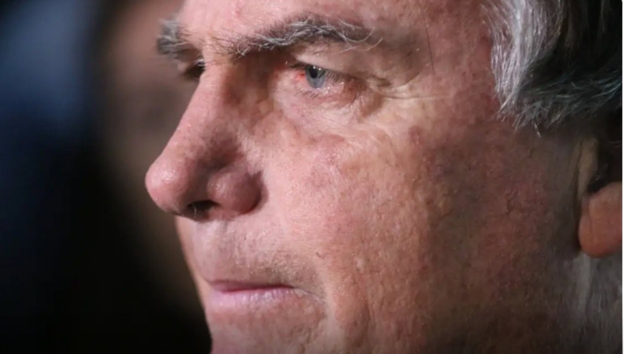 Com crise persistente de soluços, Bolsonaro faz nova cirurgia