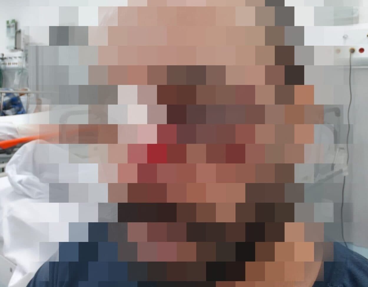Em São Bernardo, enfermeiro tem rosto fraturado após ser agredido em consultório na UPA Demarchi