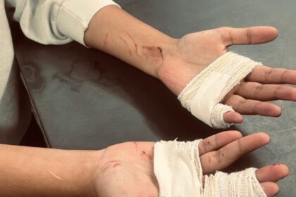 Homem que deu golpe de faca em vítima durante assalto é preso pela PM em São Bernardo