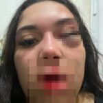“Ele pode terminar o que não conseguiu”: vítima de tentativa de feminicídio vive escondida após Justiça soltar agressor sem tornozeleira