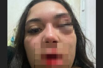 “Ele pode terminar o que não conseguiu”: vítima de tentativa de feminicídio vive escondida após Justiça soltar agressor sem tornozeleira