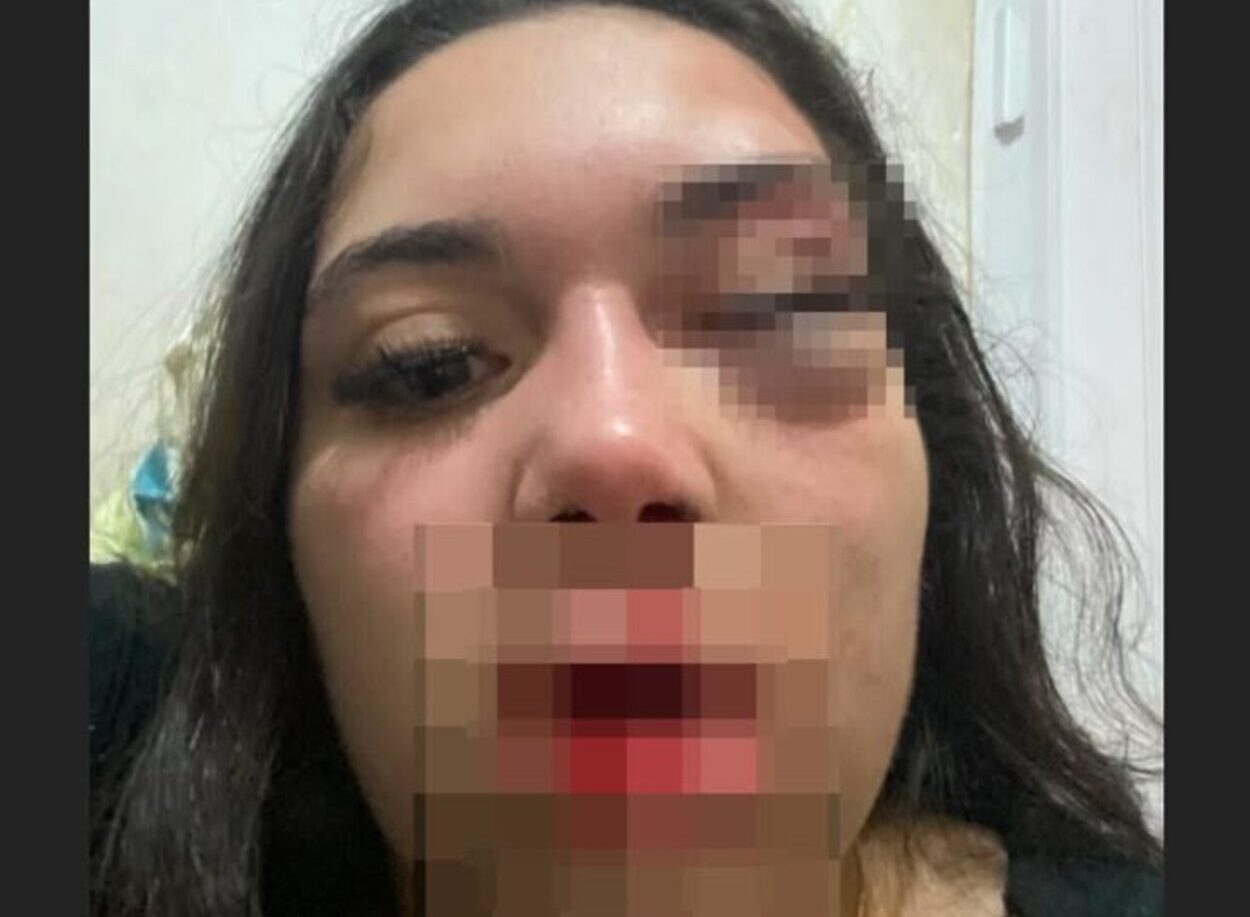 “Ele pode terminar o que não conseguiu”: vítima de tentativa de feminicídio vive escondida após Justiça soltar agressor sem tornozeleira