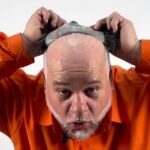 Cabelo novo, vida nova: candidato promete dar ‘tchau’ para a careca com peruca via SUS