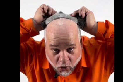 Cabelo novo, vida nova: candidato promete dar ‘tchau’ para a careca com peruca via SUS