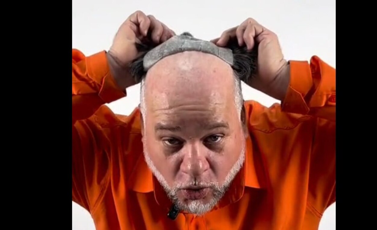 Cabelo novo, vida nova: candidato promete dar ‘tchau’ para a careca com peruca via SUS