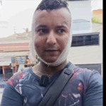 Vítima foi ferida por criminosos durante tentativa de assalto em Santo André
