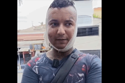 Vítima foi ferida por criminosos durante tentativa de assalto em Santo André