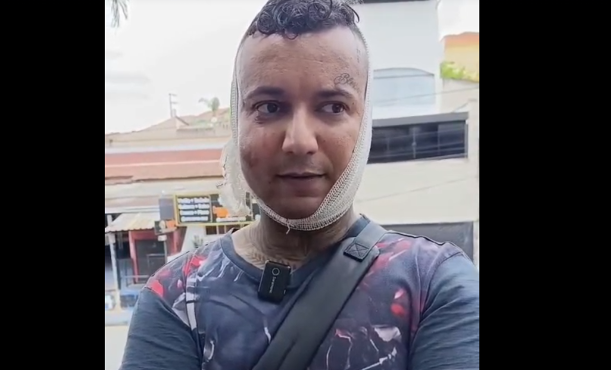 Vítima foi ferida por criminosos durante tentativa de assalto em Santo André